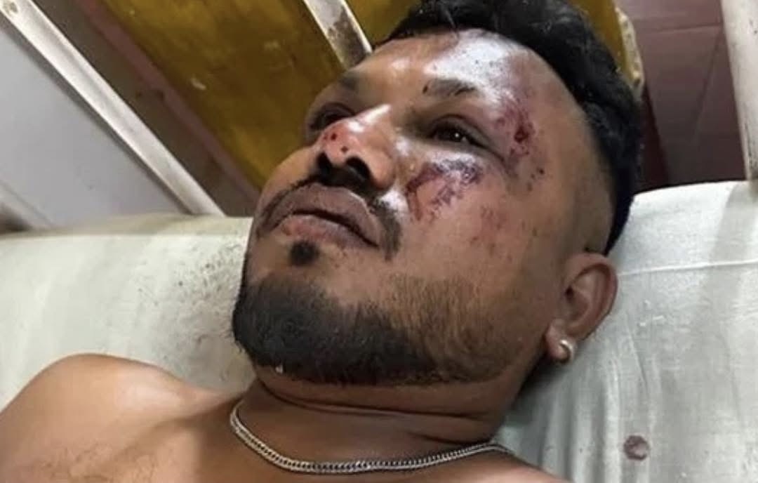 I mbijetuari i vetëm nga rrëzimi i avionit: Zbulon çdo gjë me detaje se çfarë ndodhi