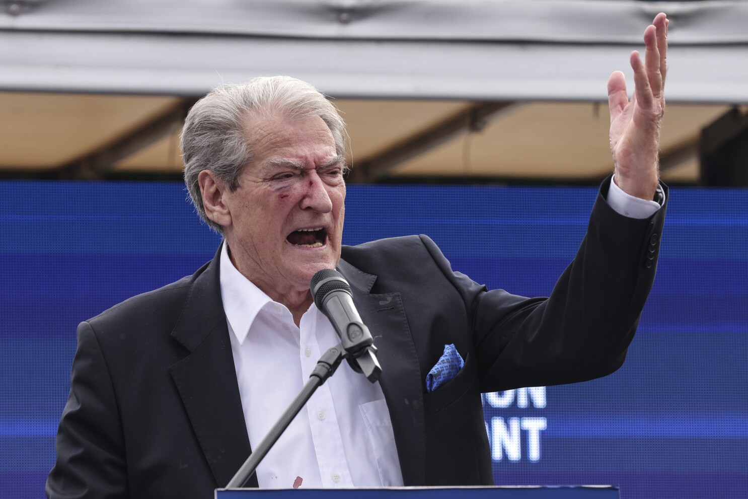 Vjen Reagimi I Papritur I Sali Berishës Rreth Vrrasjes Në Rinas- Ja Kë Po E Fajëson…?!