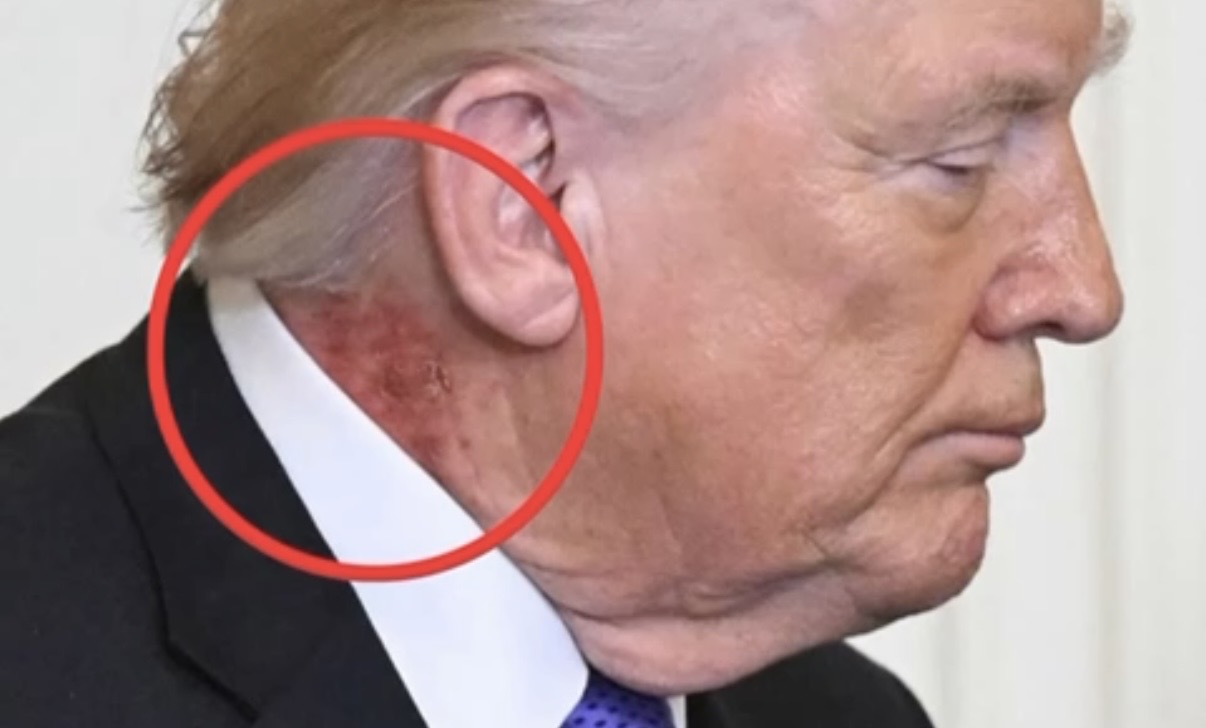 SAPO NDODHI: Trumpi në gjendje të rëndë? Ja kush ia shkaktoi…